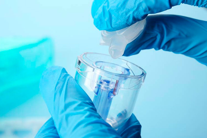 Doctor wearing gloves, putting liquid medication into a nebulizer container.